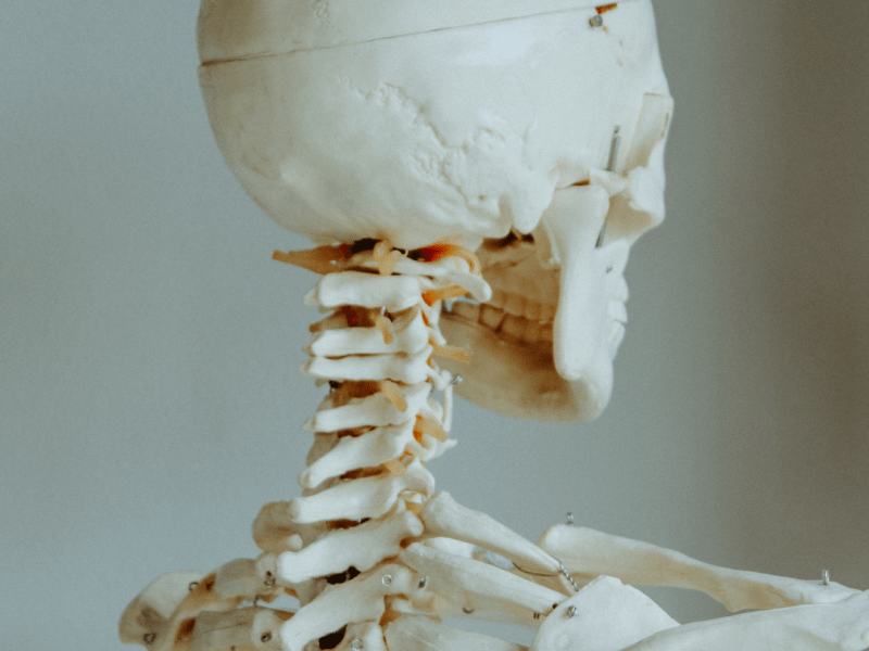 Can Chiropractors Treat Whiplash? 
