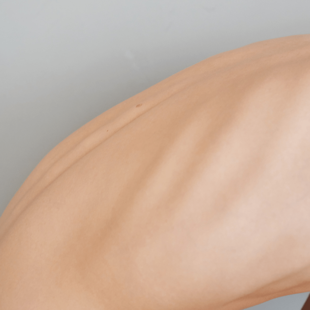 Can Chiropractors Help With Broken&nbsp;Ribs?